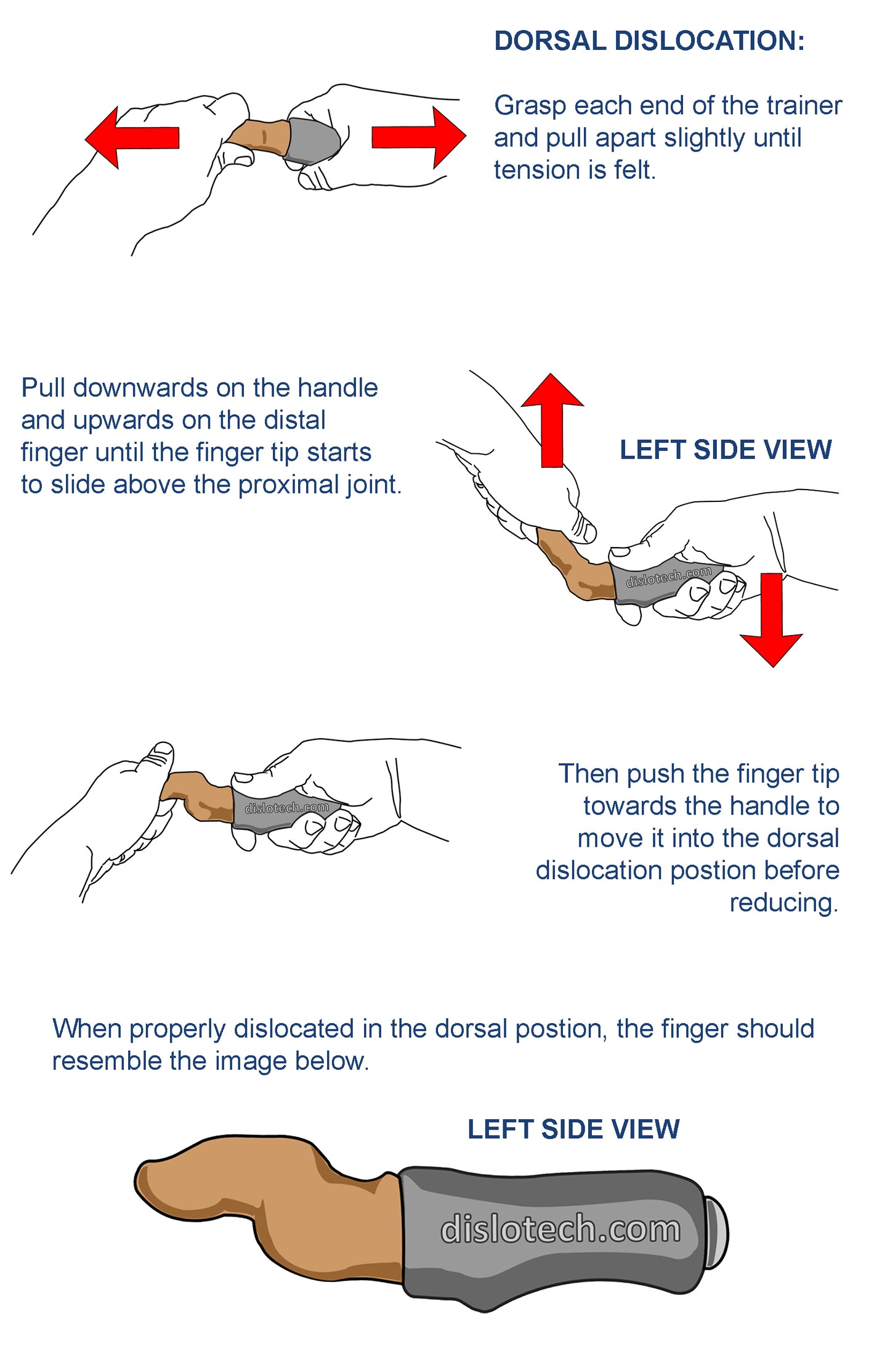 Pack of 5 Finger Reduction Trainers