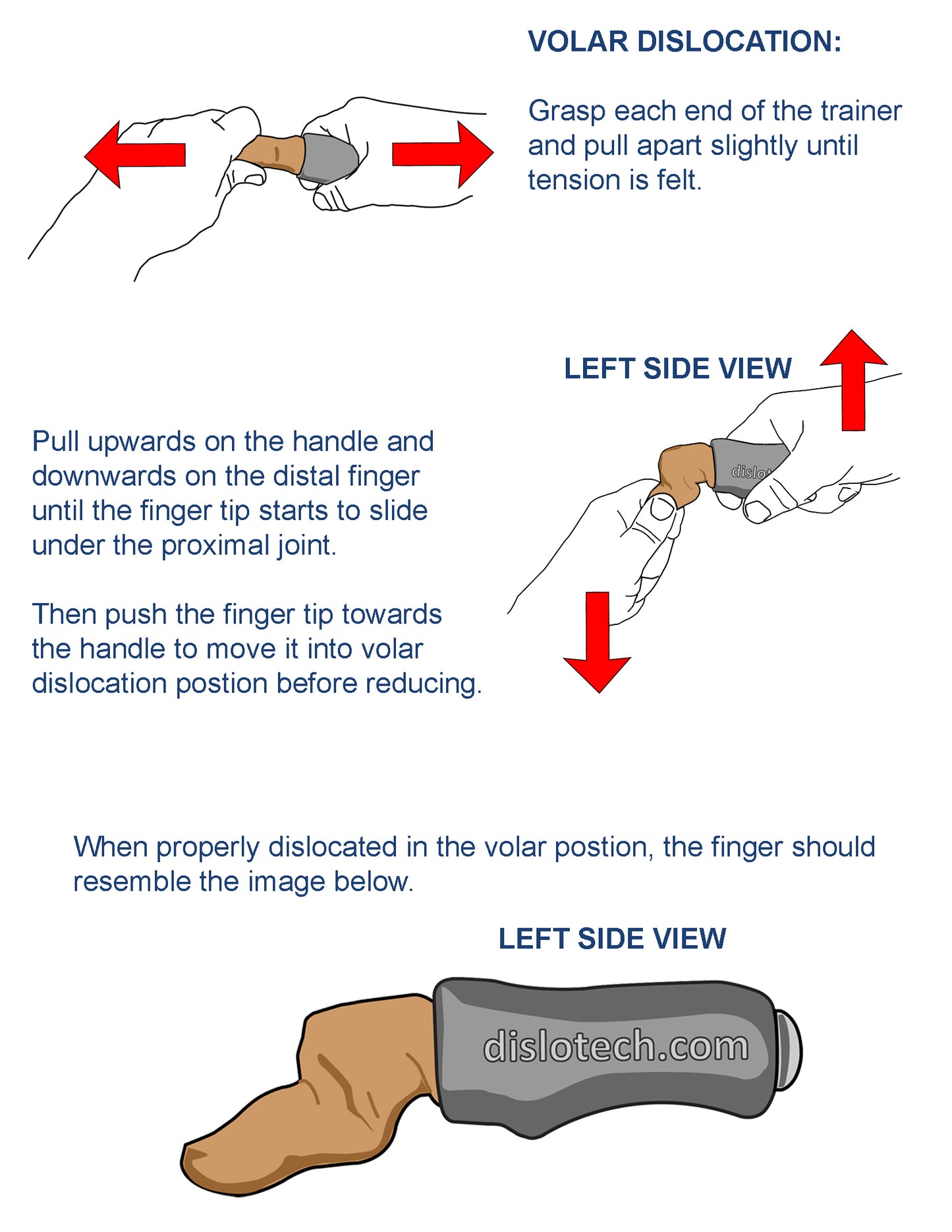 Pack of 5 Finger Reduction Trainers